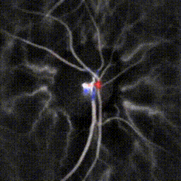 Retinal Doppler holography